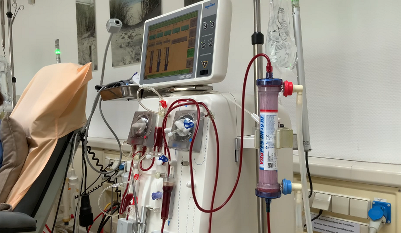 dialysis 洗腎